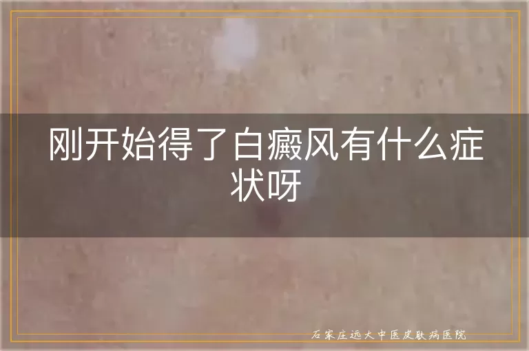 刚开始得了白癜风有什么症状呀