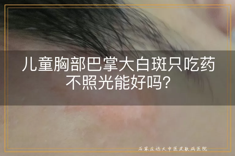 儿童胸部巴掌大白斑只吃药不照光能好吗？