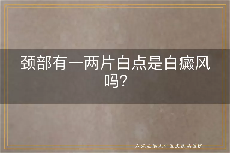 颈部有一两片白点是白癜风吗？