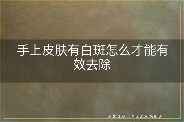 手上皮肤有白斑怎么才能有效去除