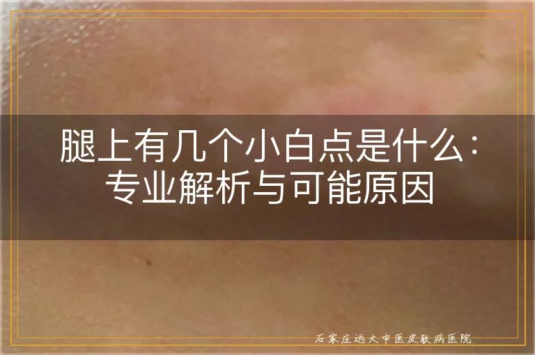 腿上有几个小白点是什么：专业解析与可能原因