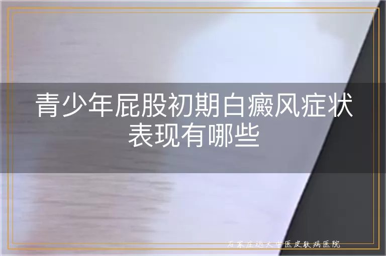 青少年屁股初期白癜风症状表现有哪些