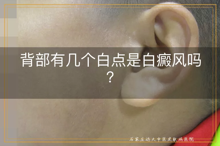 背部有几个白点是白癜风吗？