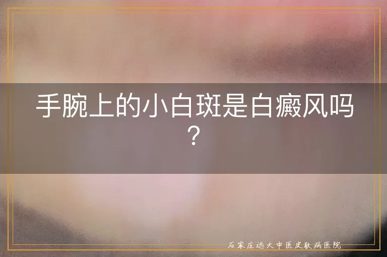 手腕上的小白斑是白癜风吗？