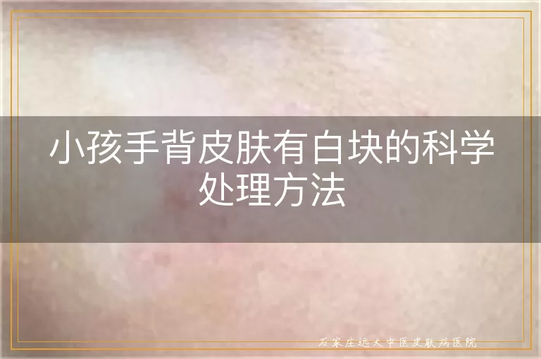 小孩手背皮肤有白块的科学处理方法