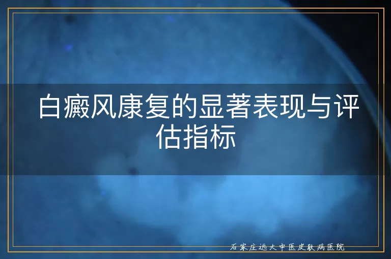 白癜风康复的显著表现与评估指标