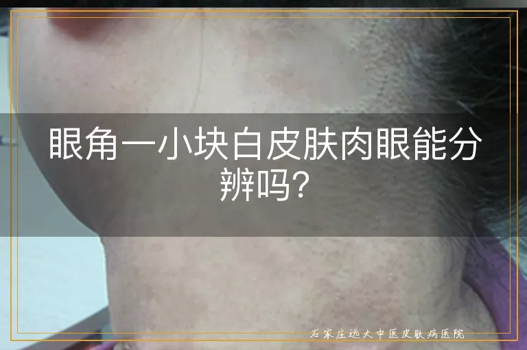 眼角一小块白皮肤肉眼能分辨吗？