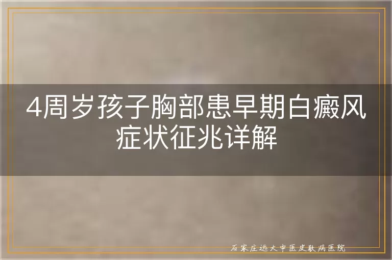 4周岁孩子胸部患早期白癜风症状征兆详解