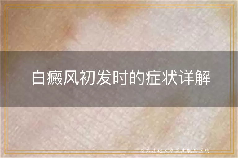 白癜风初发时的症状详解