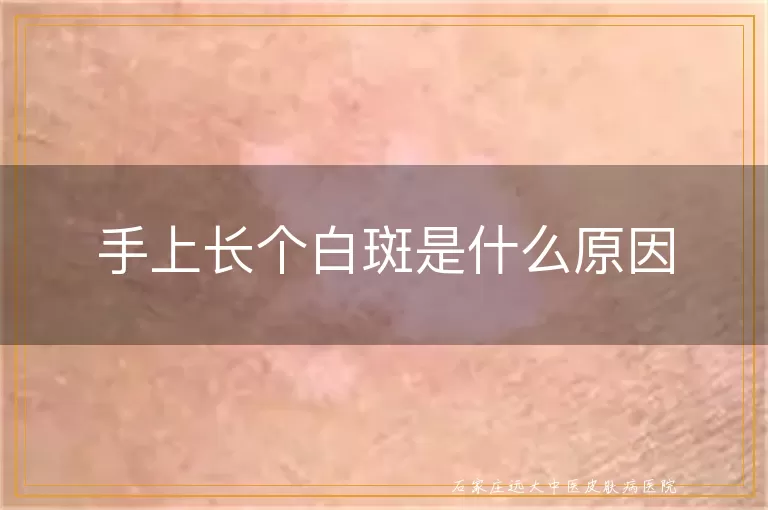 手上长个白斑是什么原因