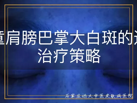 儿童肩膀巴掌大白斑的适宜治疗策略