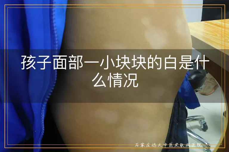 孩子面部一小块块的白是什么情况