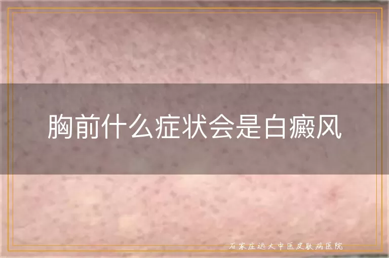 胸前什么症状会是白癜风