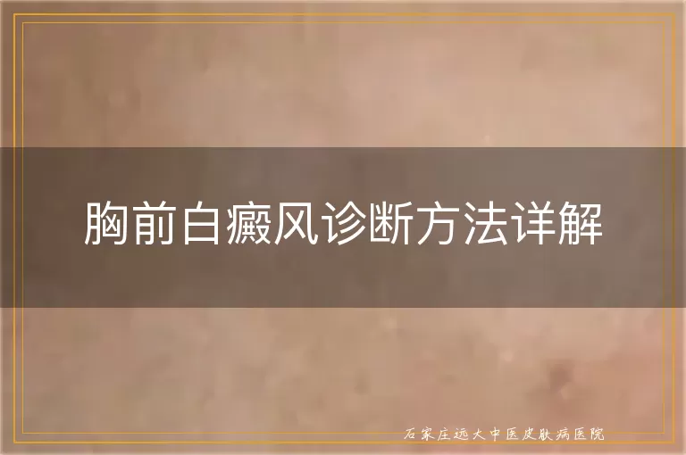 胸前白癜风诊断方法详解