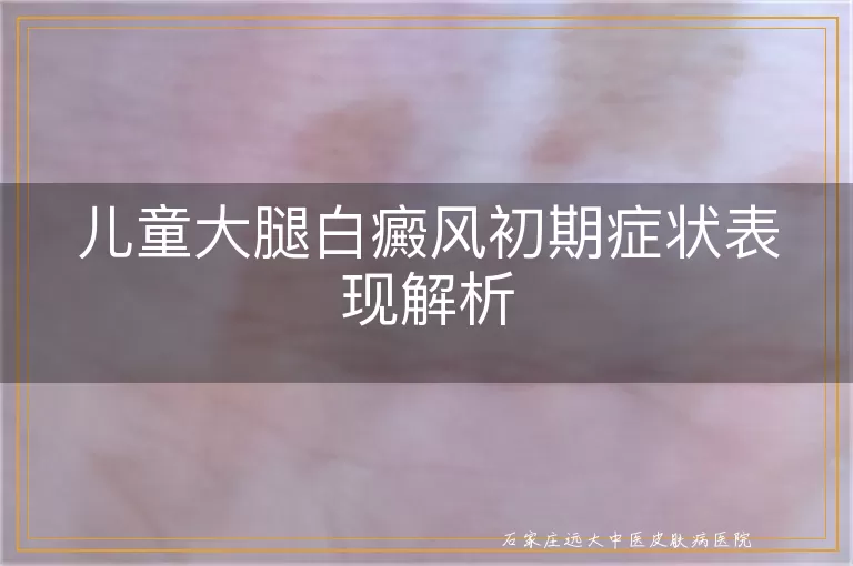 儿童大腿白癜风初期症状表现解析