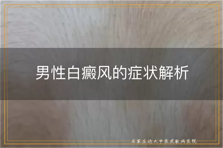 男性白癜风的症状解析