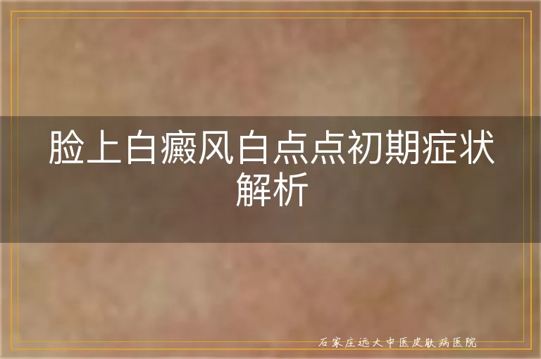 脸上白癜风白点点初期症状解析