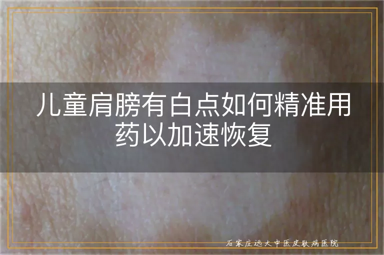 儿童肩膀有白点如何精准用药以加速恢复