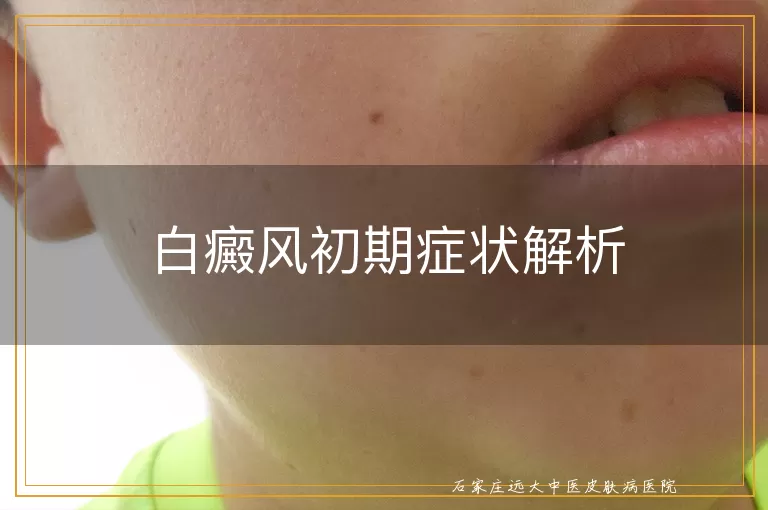 白癜风初期症状解析