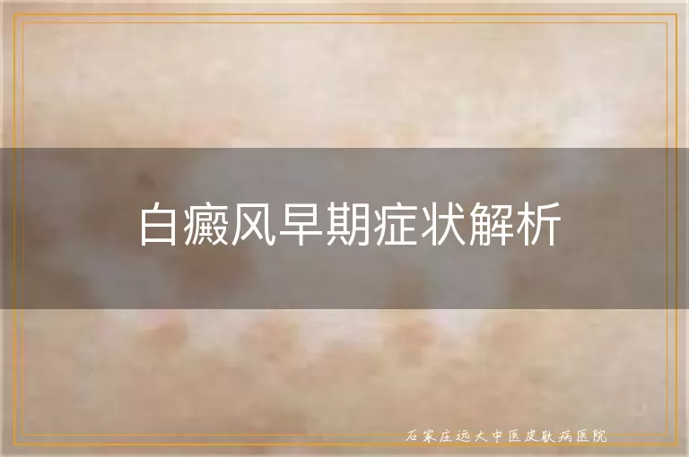 白癜风早期症状解析