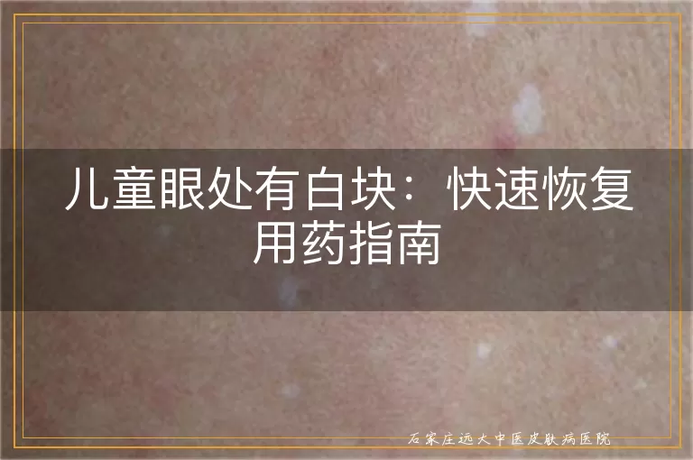 儿童眼处有白块：快速恢复用药指南