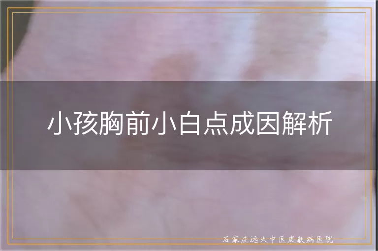小孩胸前小白点成因解析