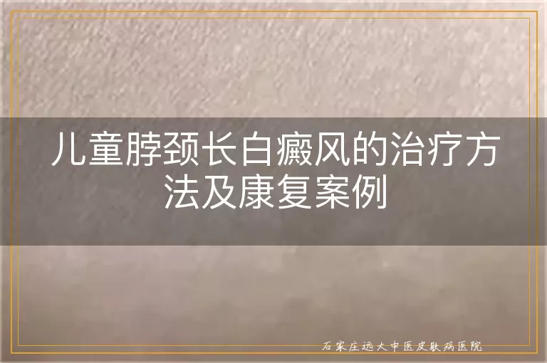 儿童脖颈长白癜风的治疗方法及康复案例