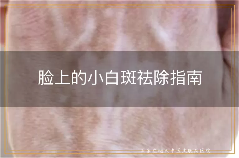 脸上的小白斑祛除指南