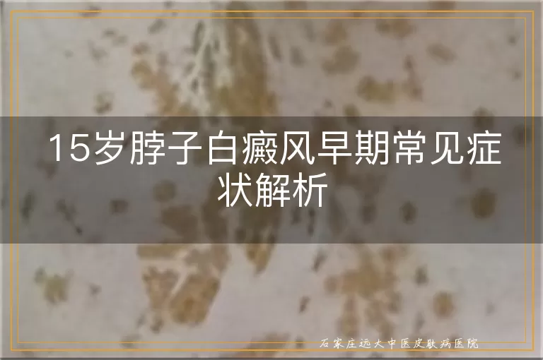 15岁脖子白癜风早期常见症状解析