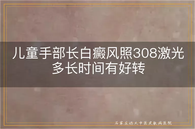儿童手部长白癜风照308激光多长时间有好转