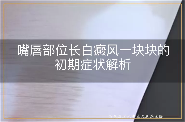 嘴唇部位长白癜风一块块的初期症状解析
