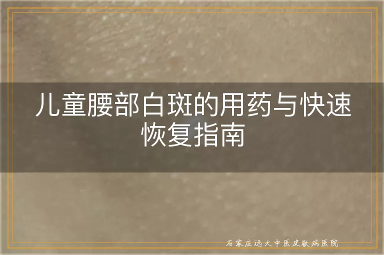 儿童腰部白斑的用药与快速恢复指南