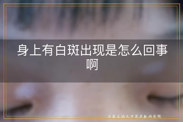 身上有白斑出现是怎么回事啊