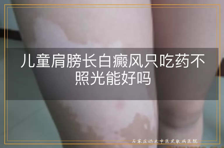 儿童肩膀长白癜风只吃药不照光能好吗