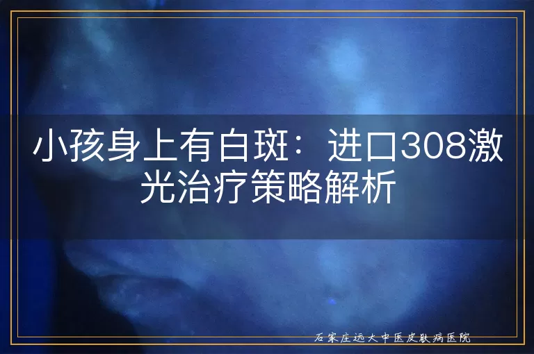 小孩身上有白斑：进口308激光治疗策略解析