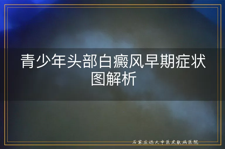 青少年头部白癜风早期症状图解析