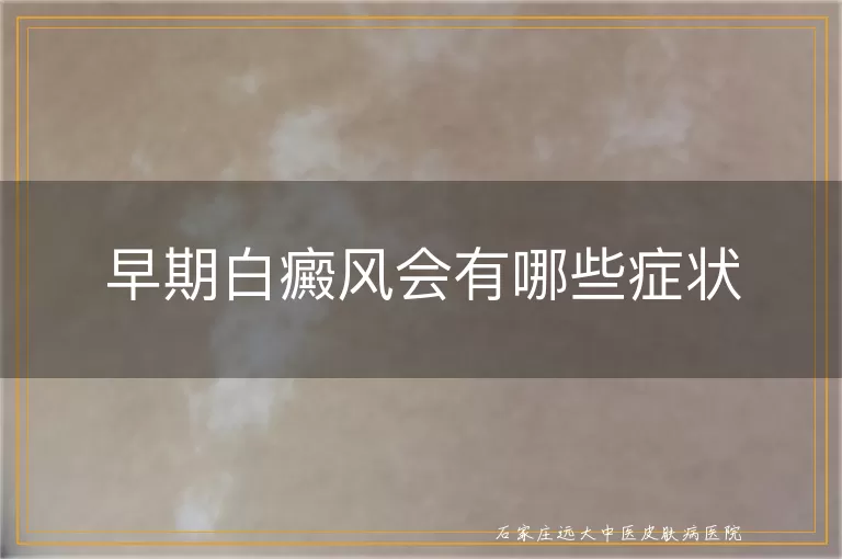 早期白癜风会有哪些症状