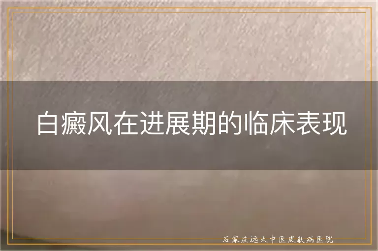 白癜风在进展期的临床表现