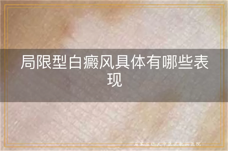 局限型白癜风具体有哪些表现
