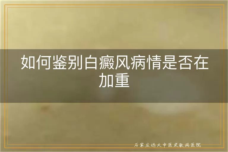 如何鉴别白癜风病情是否在加重
