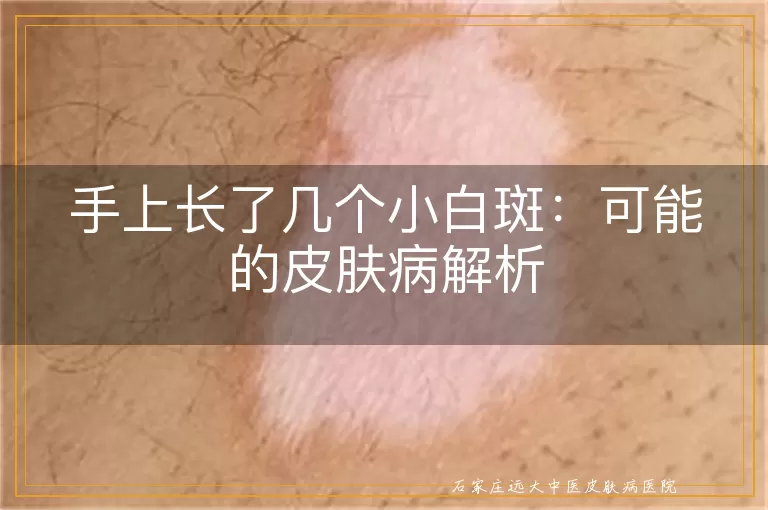 手上长了几个小白斑：可能的皮肤病解析