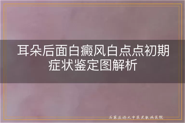 耳朵后面白癜风白点点初期症状鉴定图解析