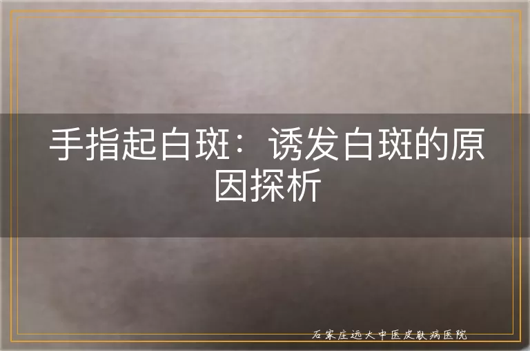 手指起白斑：诱发白斑的原因探析