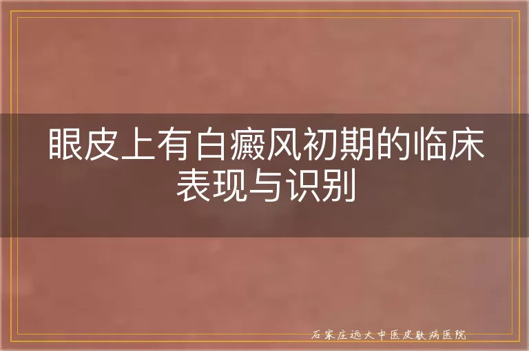 眼皮上有白癜风初期的临床表现与识别