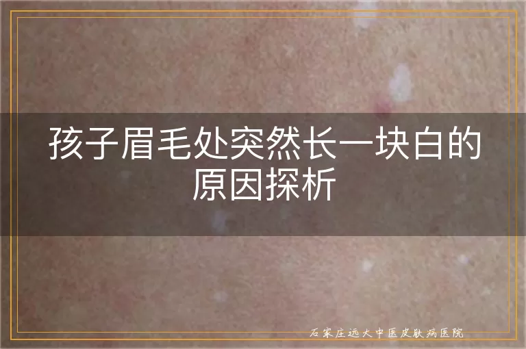 孩子眉毛处突然长一块白的原因探析