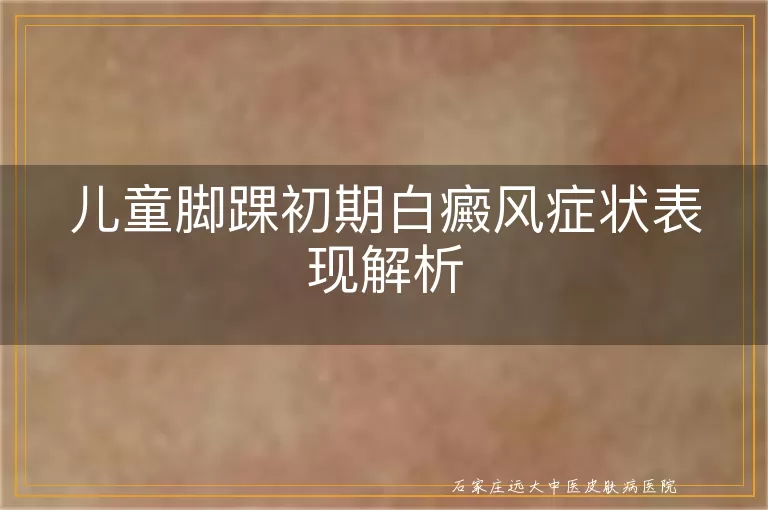 儿童脚踝初期白癜风症状表现解析