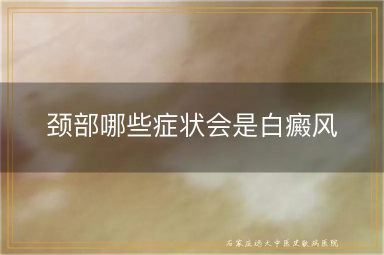 颈部哪些症状会是白癜风