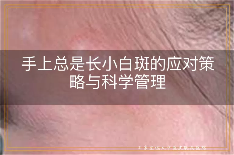 手上总是长小白斑的应对策略与科学管理