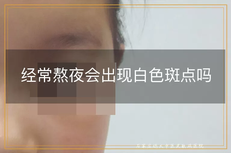 经常熬夜会出现白色斑点吗