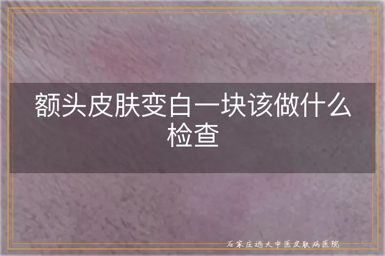 额头皮肤变白一块该做什么检查